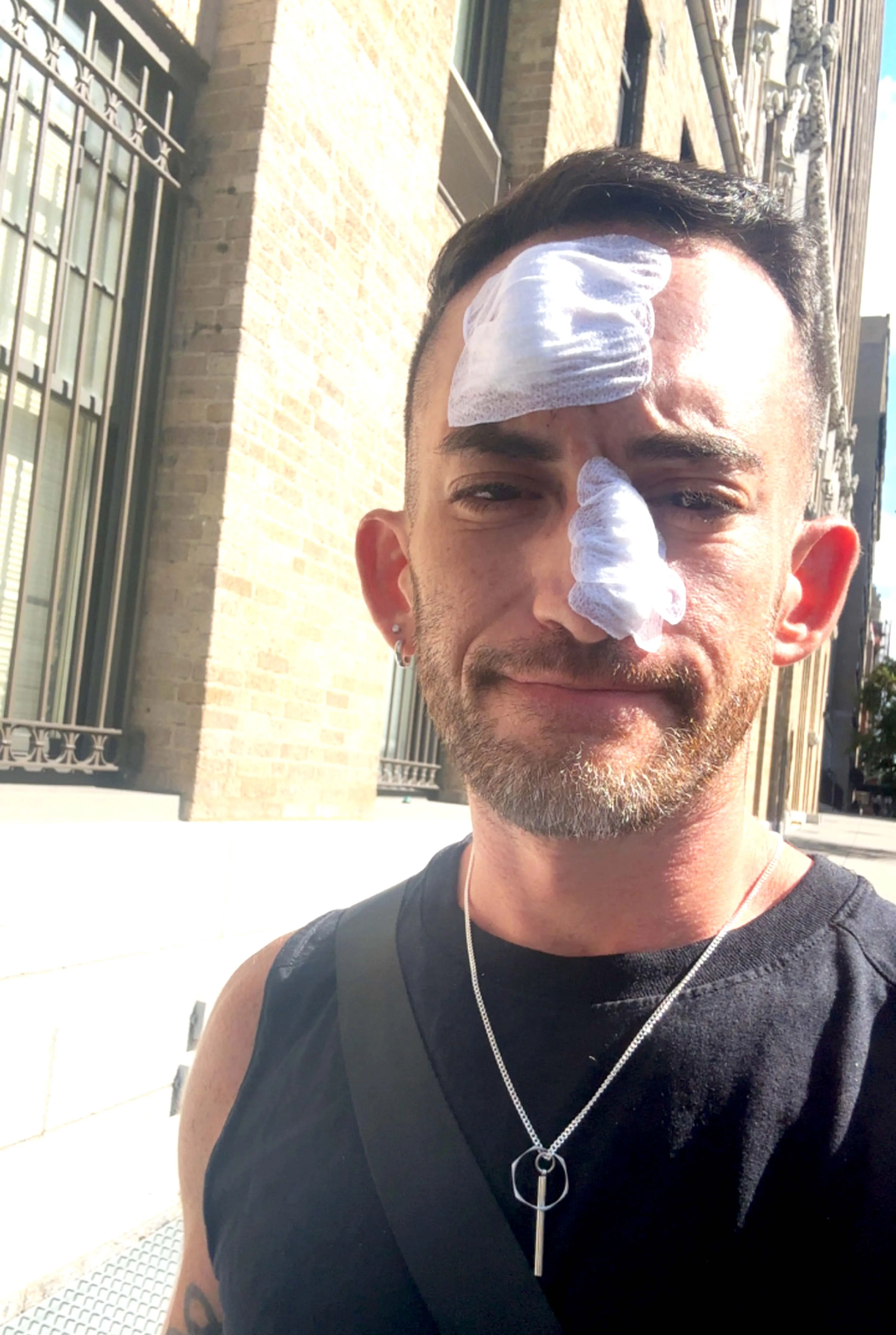 The Hidden Dangers of Skipping Sunscreen During Outdoor Runs